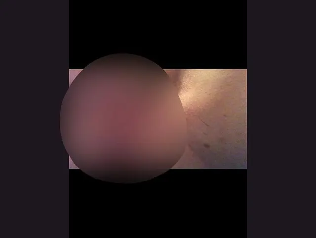 Harnröhre Dehnung pissröhre Bsdm reife Frau