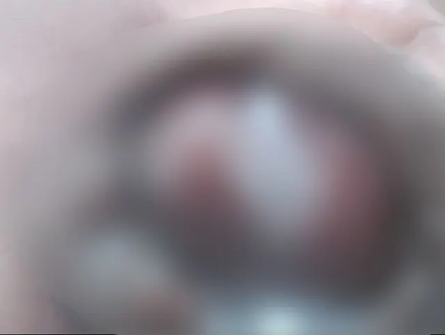 ONLY CLOSE UP