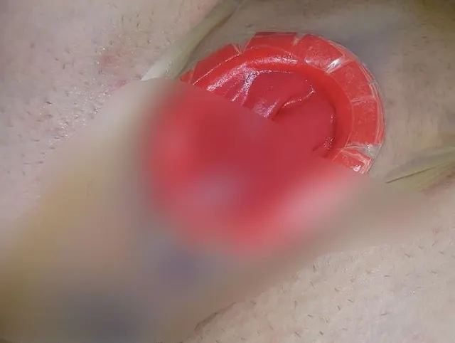 Frauen Kondom Selbstgemacht! Latex Slip Condom!