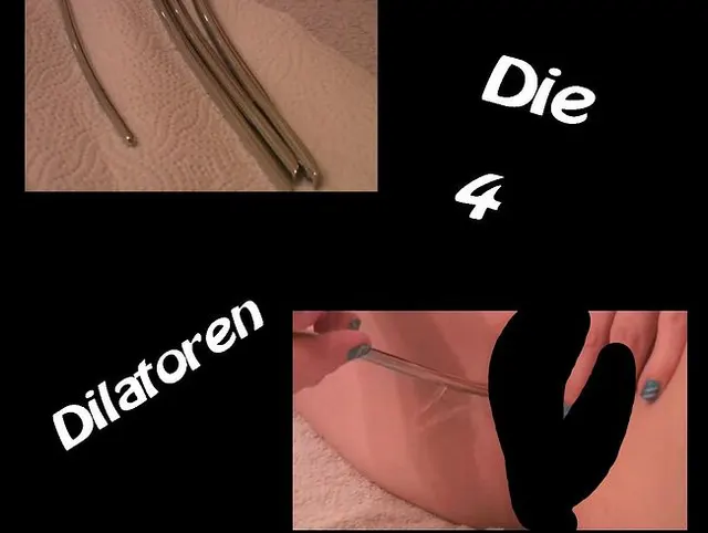 Die 4 Dilatoren