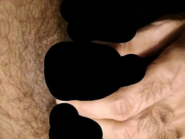 closeup foreskin