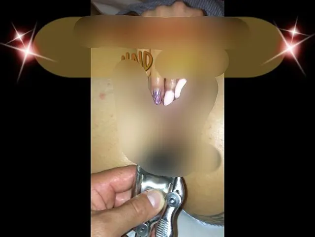 Spekulum im Arsch und Anal