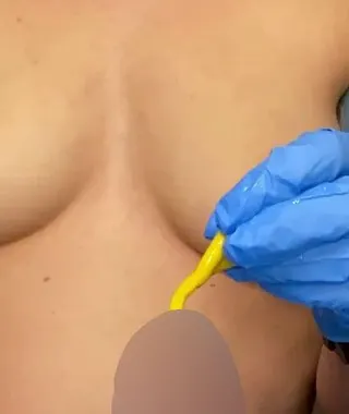 Handjob mit Katheter