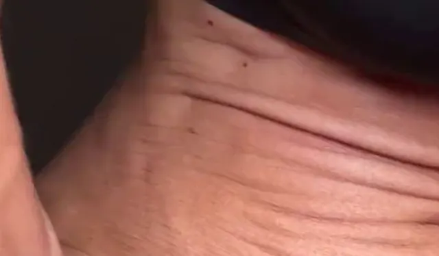 Fingeraktion