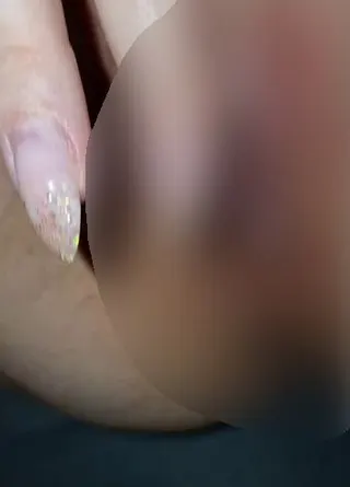 1te mal den Piercingschlitz benutzt