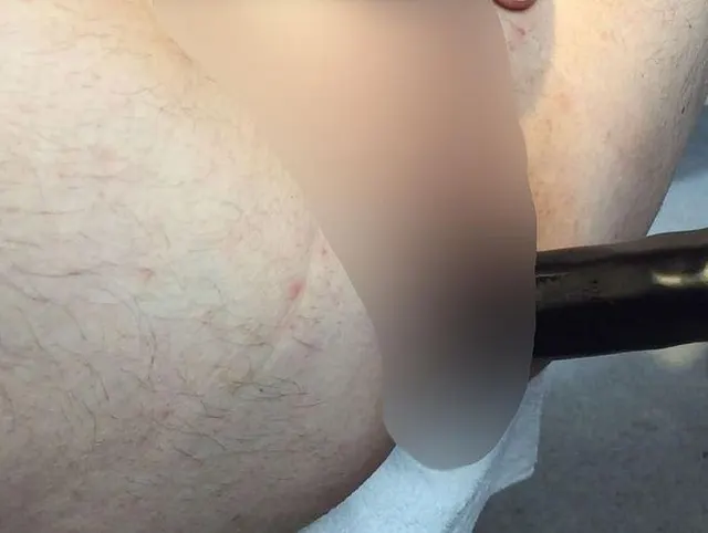Fisting 4 Extrem Hart gefistet Teil 3-6 Mit Riesendildos