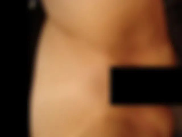 Anal