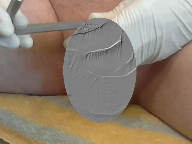 Telekolleg Sounding (Cockstuffing, Urethral Stimulation) Folge 3