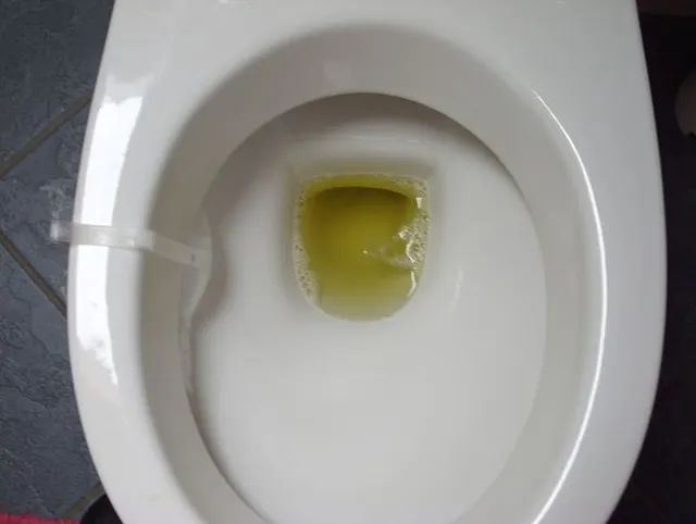 WC  Pissen !